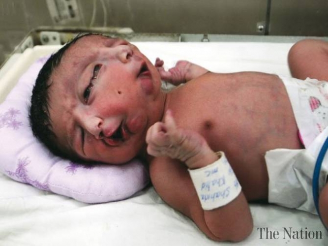 baby-2-born-pindi-1324312309.jpg