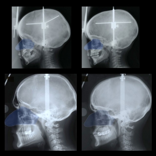 nose-comparison-640x640.jpg