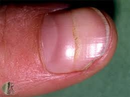 nail 2.jpg