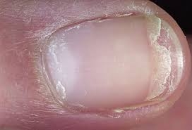 nail.jpg