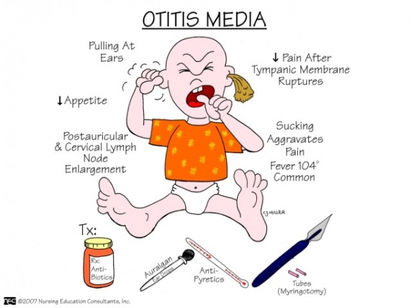 Otitis_Media.jpg