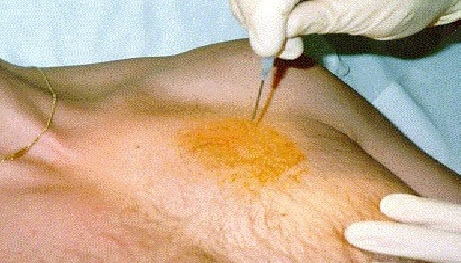 slide-25-728.jpg