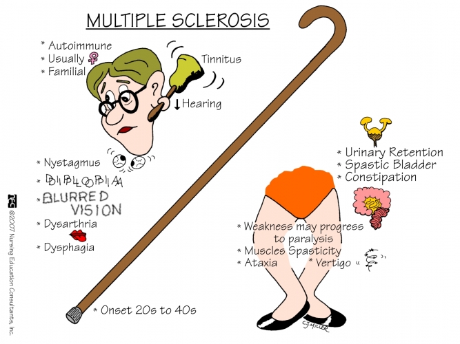Multiple_Sclerosis2.jpg